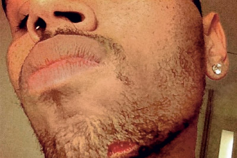 Chris Brown: Stepel se je (foto: Profimedia.si)