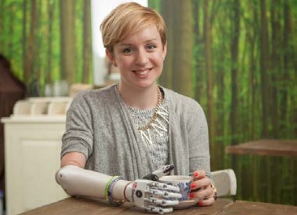 Spoznajte Nicky Ashwell, ki med prvimi uporablja bionsko roko (foto: Steeper, BeBionic)