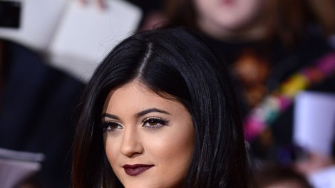 Ustnice Kylie Jenner - prej in potem!