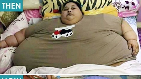 Najdebelejša ženska na svetu izgubila polovico svoje teže