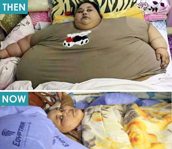 Najdebelejša ženska na svetu izgubila polovico svoje teže (foto: profimedia)