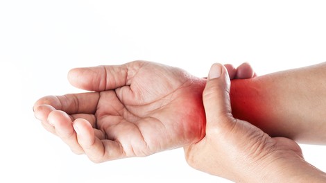 Artritis: Pod tem pojmom je poznanih več kot 100 vrst te bolezni