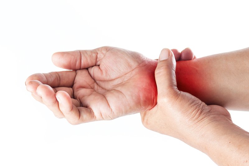 Artritis: Pod tem pojmom je poznanih več kot 100 vrst te bolezni (foto: Shutterstock)