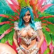 Rihanna: Obline kipele na vse strani