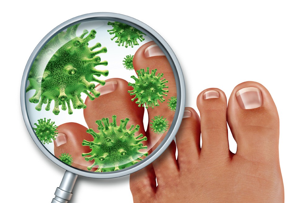 Nad glivično okužbo nohtov s preventivo! (foto: Shutterstock)