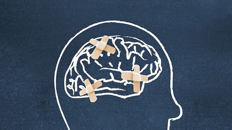 Raziskava: Pametnejši ljudje so bolj nagnjeni k duševnim boleznim