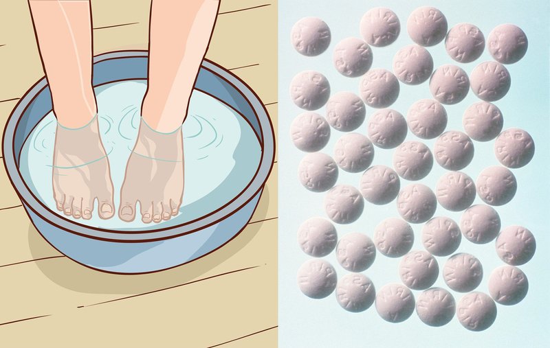 Triki z aspirinom, ki bi jih morale poznati vse ženske! (WOW, kakšni rezultati!) (foto: Profimedia)