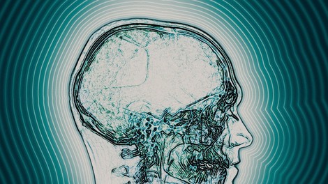 Ob dolgotrajnem sedenju se naši možgani zmanjšujejo, pravijo znanstveniki