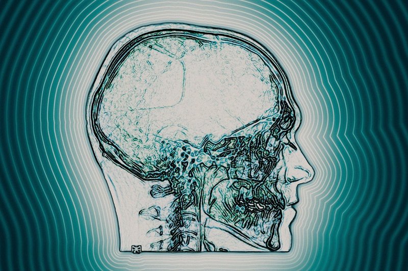 Ob dolgotrajnem sedenju se naši možgani zmanjšujejo, pravijo znanstveniki (foto: Profimedia)