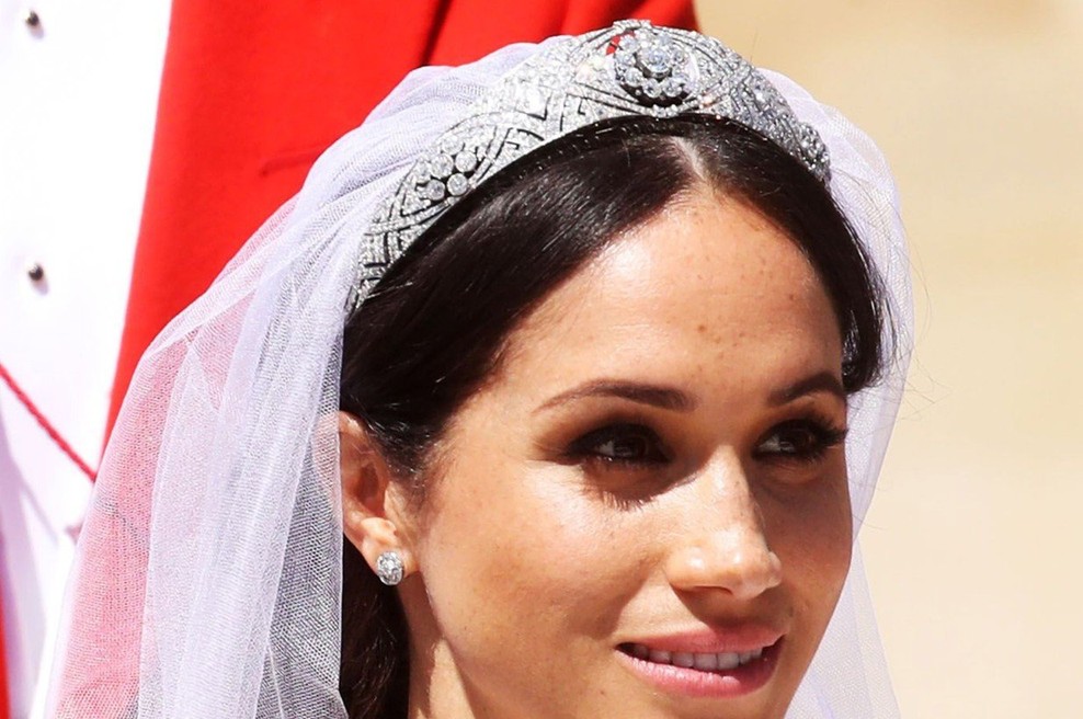 Kraljeva poroka in novi trendi: Zaradi Meghan ženske začenjajo sprejemati svoje sončne pege (foto: Profimedia)