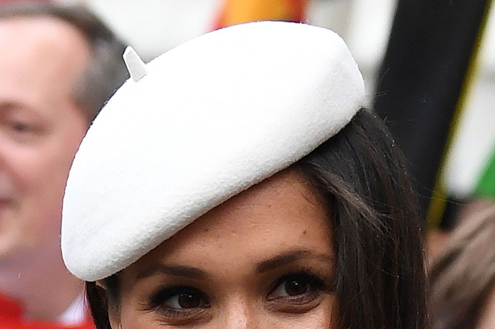 Je nos Meghan Markle delo lepotnih kirurgov? (foto: Profimedia)