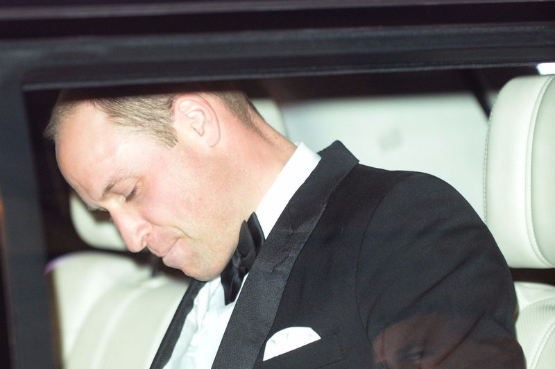 Princ William ima na čelu že dolgo časa veliko brazgotino (foto: Profimedia)