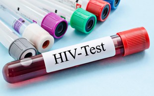 HIV/aids je še vedno med nami (Testirate se lahko tudi anonimno)