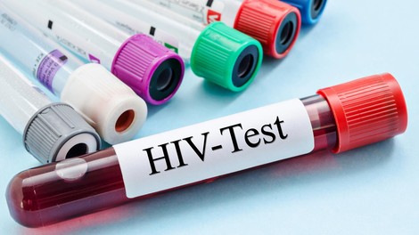 HIV/aids je še vedno med nami (Testirate se lahko tudi anonimno)