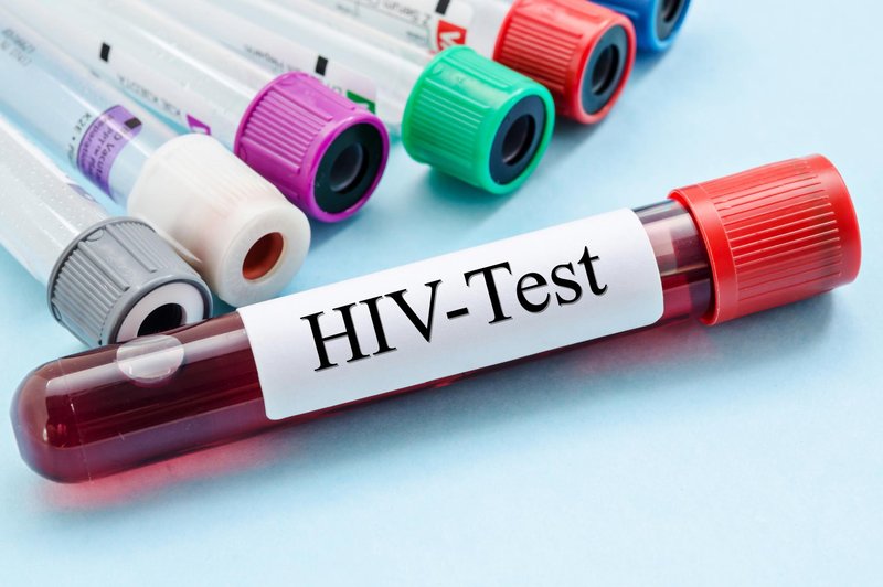 HIV/aids je še vedno med nami (Testirate se lahko tudi anonimno) (foto: SHUTTERSTOCK)