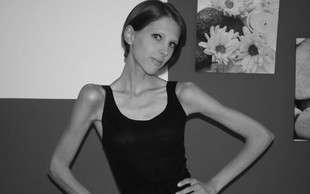 Špela Kranjec s svojo zgodbo o 9-letnem boju z anoreksijo odhaja na Kickstarter