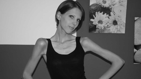 Špela Kranjec s svojo zgodbo o 9-letnem boju z anoreksijo odhaja na Kickstarter