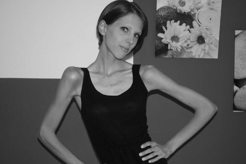 Špela Kranjec s svojo zgodbo o 9-letnem boju z anoreksijo odhaja na Kickstarter (foto: Osebni arhiv)