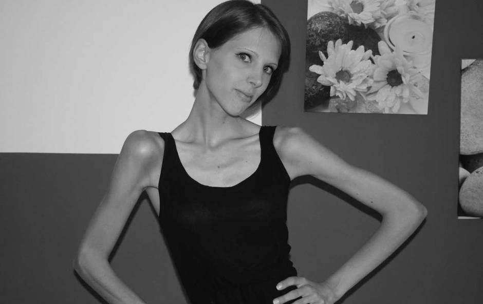 Špela Kranjec s svojo zgodbo o 9-letnem boju z anoreksijo odhaja na Kickstarter (foto: Osebni arhiv)