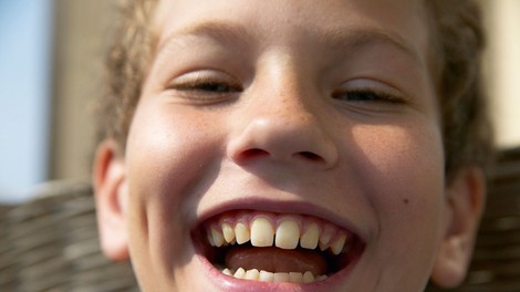 Razlaga sanj: Zobje so znamenje za razmišljanje in skrb za lep videz!