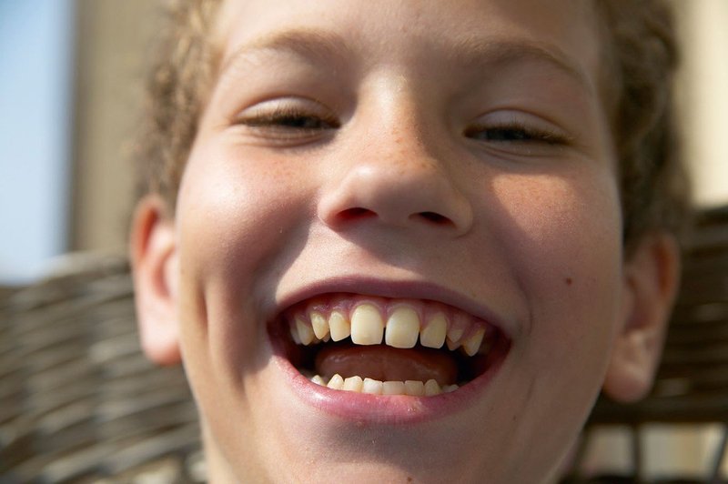 Razlaga sanj: Zobje so znamenje za razmišljanje in skrb za lep videz! (foto: profimedia)