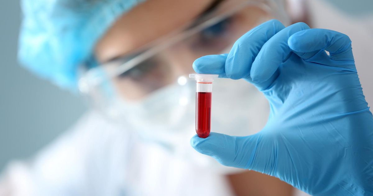 Se puede tomar medicamentos antes de un analisis de sangre