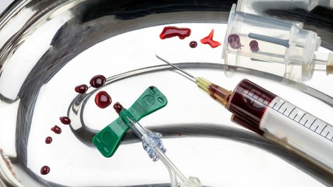 FDA poziva Američane, naj prenehajo s 'pomlajevalnimi' infuzijam mlade krvi