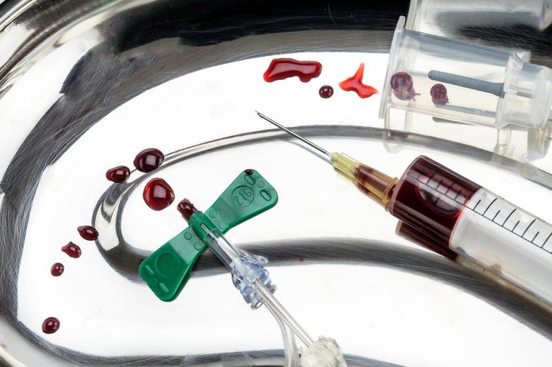 FDA poziva Američane, naj prenehajo s 'pomlajevalnimi' infuzijam mlade krvi (foto: profimedia)