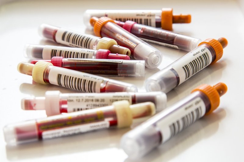 V Nemčiji razvili potencialen krvni test za raka dojk (foto: profimedia)