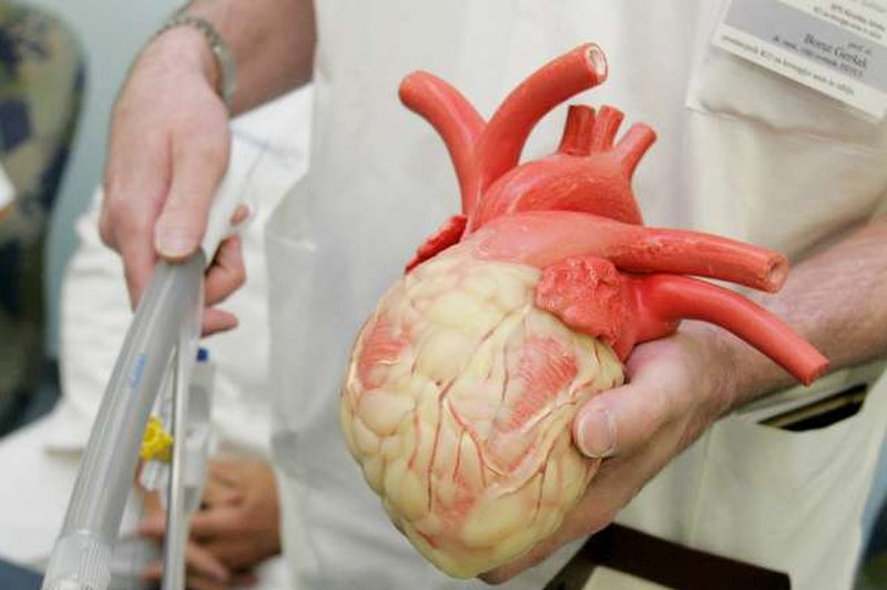 Izraelski znanstveniki natisnili srce iz človeškega tkiva (foto: STA)