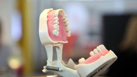 Zobozdravniki odsvetujejo uporabo zobne paste z aktivnim ogljem