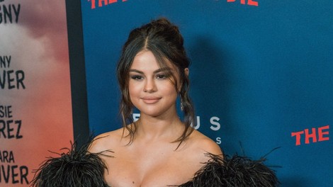 Ameriški mediji prepričani, da ima Selena Gomez umetne ustnice