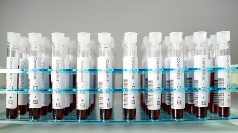 Na Kitajskem novo množično testiranje na novi koronavirus