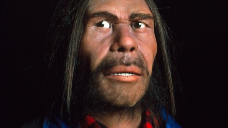Bi krivca za težjo obliko covida lahko iskali v neandertalskem genu?