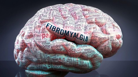 Fibromialgija: desetletja skrivnosti in zmot o bolezni razširjene kronične bolečine