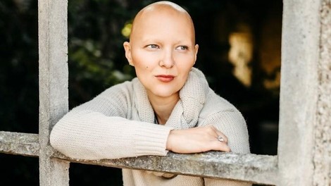 Mateja Osredkar o novem zdravilu za alopecijo: "Želim si zdravljenja vzrokov, ne simptomov."
