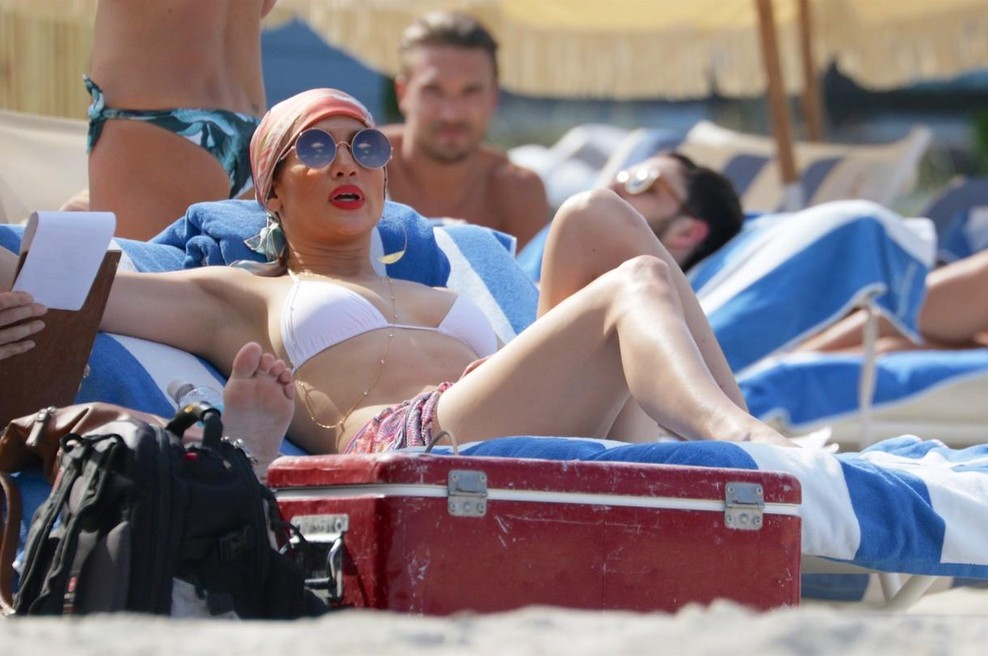 Vas je opeklo sonce? To so domači pripravki, ki zares pomagajo (foto: Profimedia)