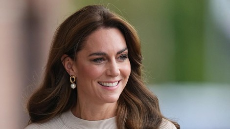 Zdravnik zdaj pojasnil, kaj bi se utegnilo zgoditi z lasmi Kate Middleton, zdaj, ko se zdravi zaradi raka