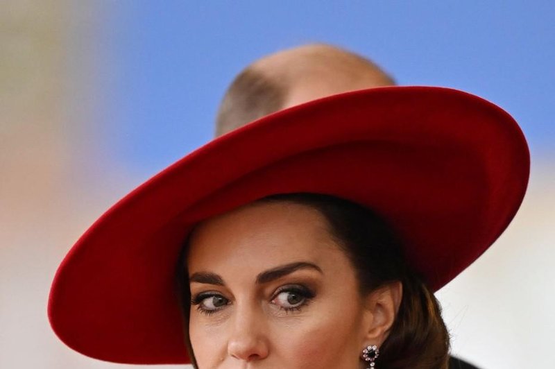 To so vse bolezni Kate Middleton in mnogi tega sploh niso vedeli! (foto: Profimedia)