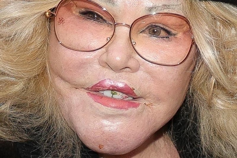 Jocelyn-Wildenstein.jpg