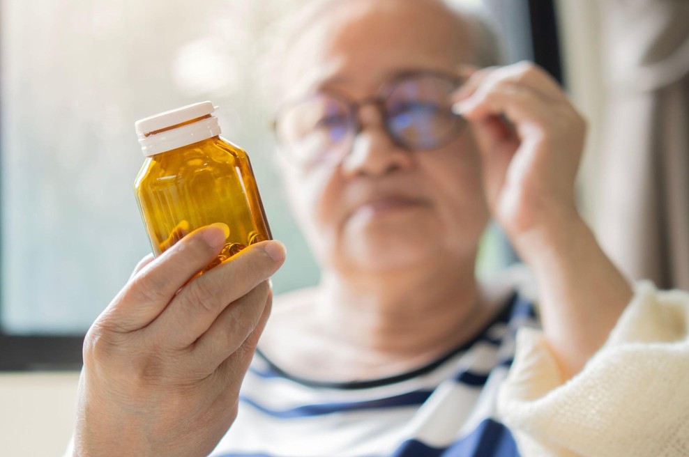 Pomanjkanje teh vitaminov lahko povzroči hitrejše sivenje las, trdi zdravnica (foto: profimedia)