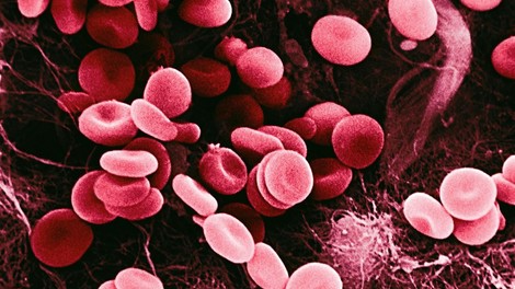 raziskave, holesterol