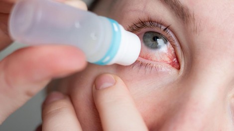 fentaniyl, očesne kapljice