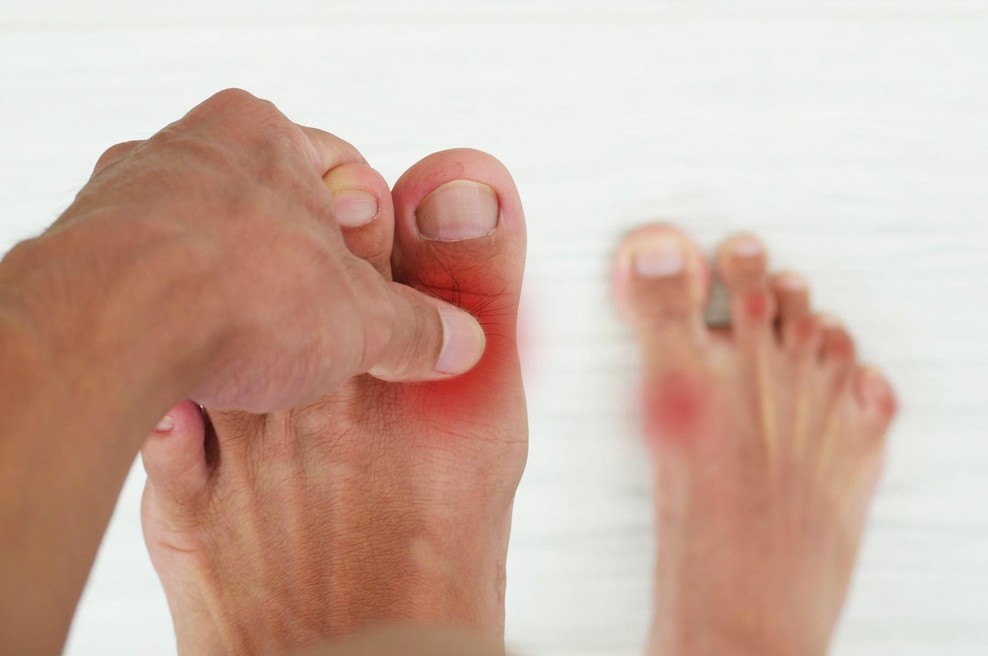 Obsežna študija razkriva, od kod izvira putika - in ni tako, kot smo mislili (foto: profimedia)