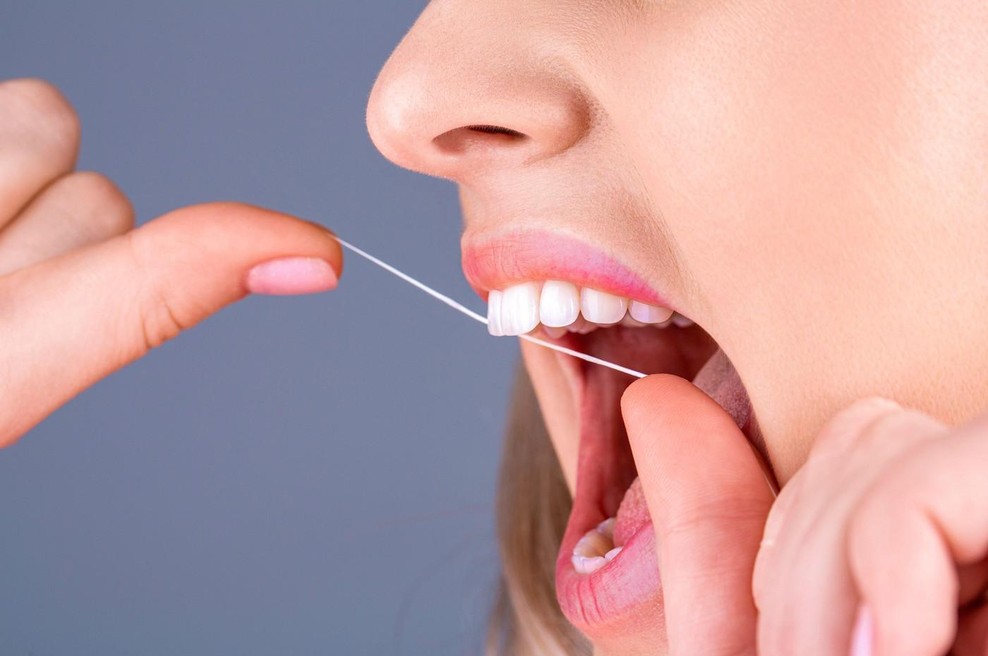 Kako izbrati zobno nitko: Najdražja ni najboljša (foto: Profimeda)