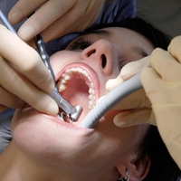 Šok za številne: Odhod k zobozdraniku bo za mnoge odslej veliko dražji