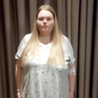 Osupljiva preobrazba: komaj je hodila s palico, zdaj pa moški ne morejo odtrgati pogleda z nje