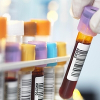 Misterij, ki traja že leta: Cela vas mora na testiranje DNK