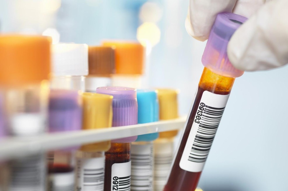 Misterij, ki traja že leta: Cela vas mora na testiranje DNK (foto: Profimedia)