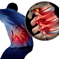 Bolečine v hrbtu: Fizioterapevti razkrivajo 7 vaj, ki prinesejo takojšnje olajšanje